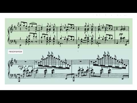 Balakirev Islamey - Paul Barton FEURICH Harmonic Pedal piano