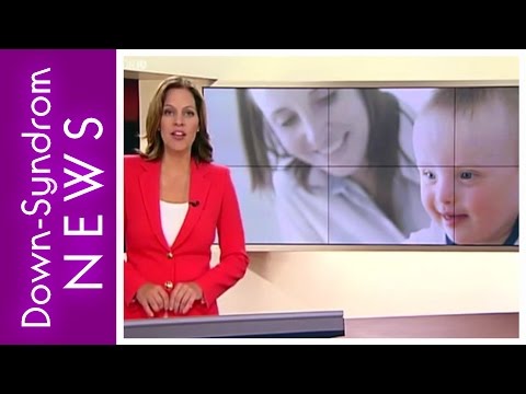 Viel mehr Kinder mit Trisomie 21
