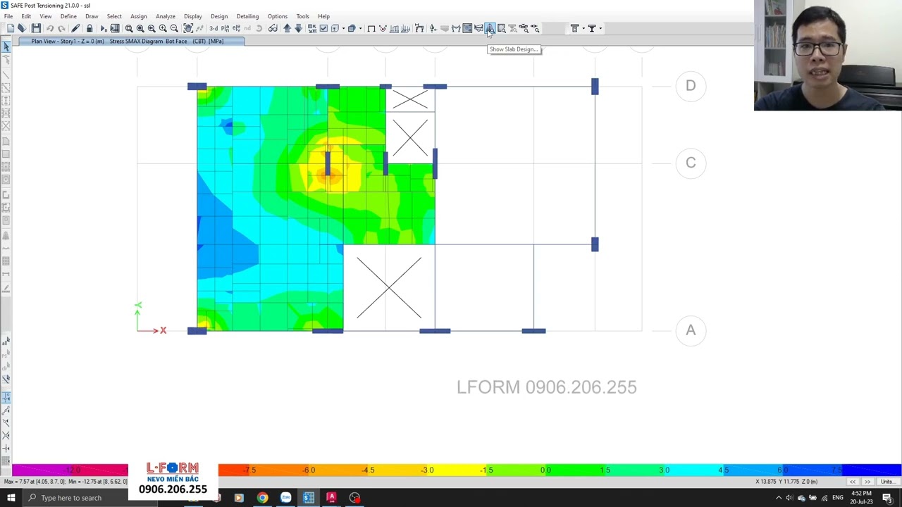 [THIẾT KẾ] HỘI CHỨNG SỢ LỖ MỞ LỚN - ĐẶC BIỆT CHÚ Ý
