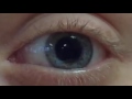 Pupil Dilation and Contraction