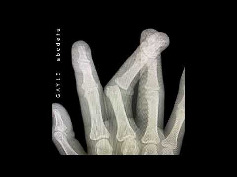 GAYLE - abcdefu (Krimsonn 2010s Remix)