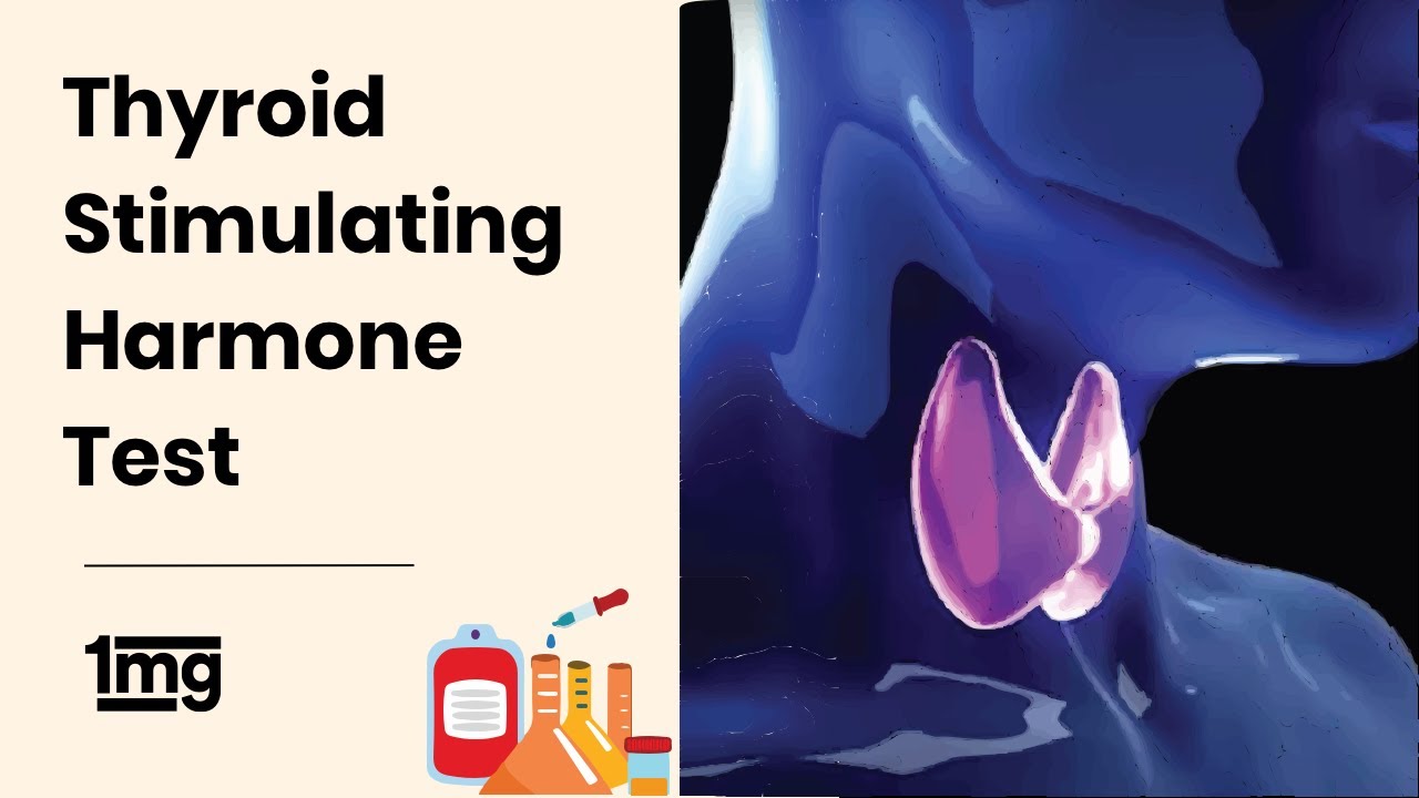Why Thyroid Stimulating Hormone (TSH) Test is Recommended