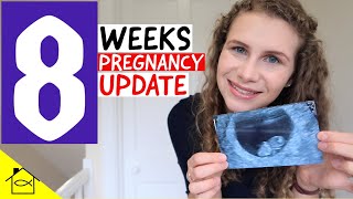 My EARLY PREGNANCY Reassurance Scan (Private UK Scan) | 8 Weeks Pregnancy Update