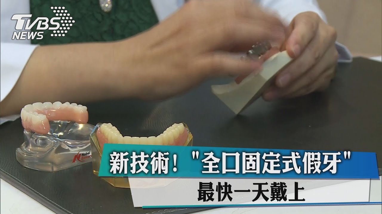 新技術!全口固定式假牙 最快「一天」戴上