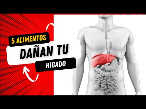 5 alimentos que dañan tu hígado