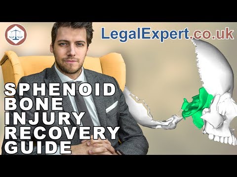 Sphenoid Bone Injury Recovery Guide ( 2019 ) UK