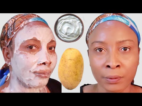 , title : 'HOW I USE POTATO TO LIFT FIRM MY SKIN, CLEAR DARK SPOTS + LIGHTEN THE SKIN'