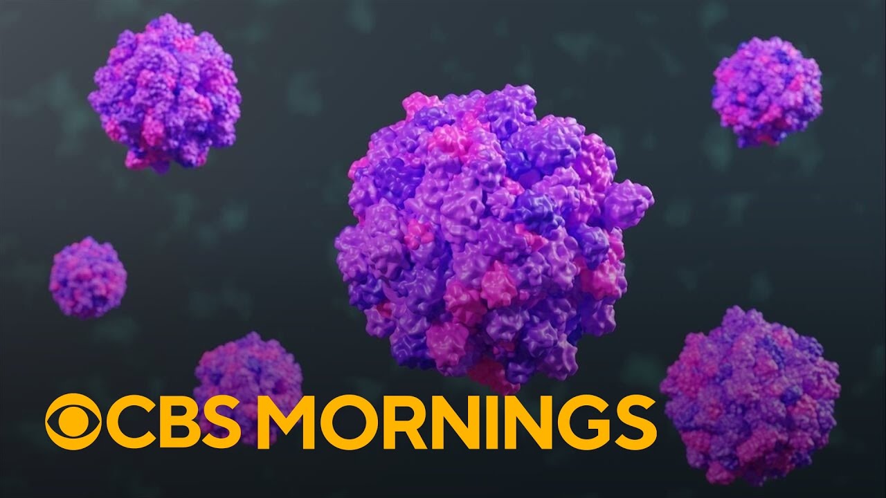 Highly contagious norovirus spreading across the U.S. ahead of holidays