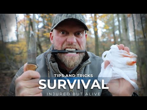 Survival Hack to when Dealing with Injuries: Fire Starting One Handed!