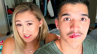 i BROKE MY FACE! + MUSTACHE REVEAL!!