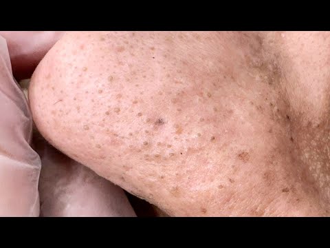 Extraction, Soothing Deep Facial Cleansing Routine