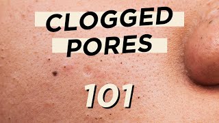 🤭Everything you need to know about CLOGGED PORES • Skincare & makeup products are not the culprit