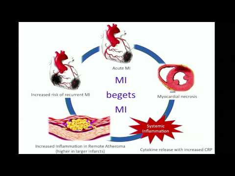 5th Annual TMII Symposium - 2015 - Session III - Cardiovascular Imaging