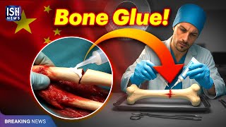 Chinese Scientists Develop Bone Glue That Heals Fractures in Minutes