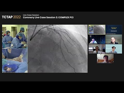 [TCAP 2022] Coronary Live Case Session 3: COMPLEX PCI