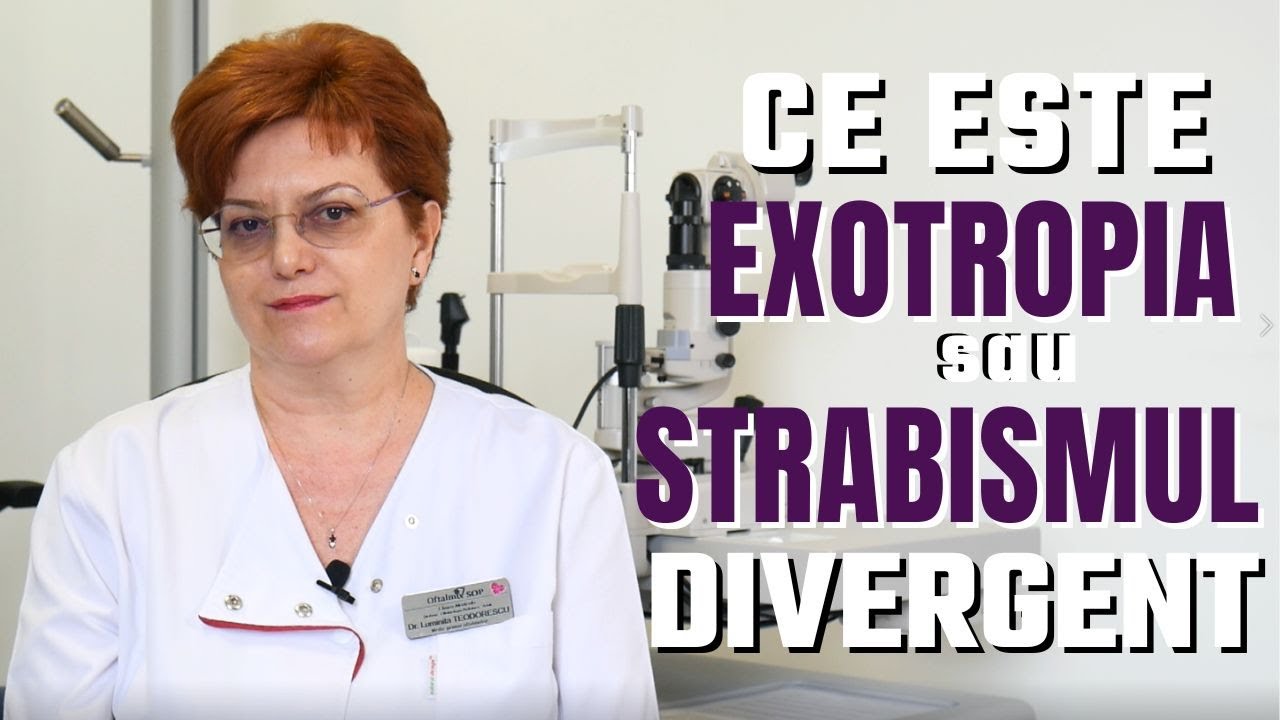 Ce este exotropia, sau strabismul divergent?