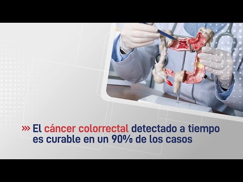El cáncer colorrectal detectado precozmente es curable en un 90% de los casos