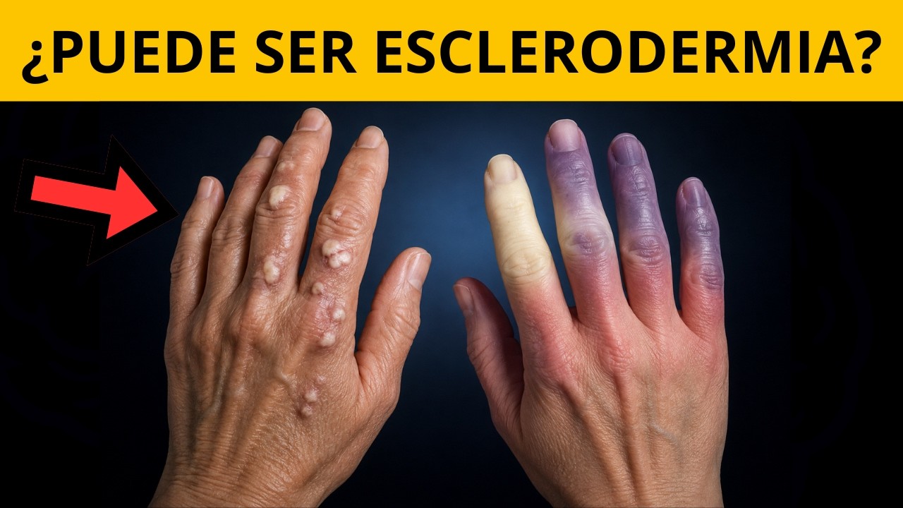 La enfermedad que ENDURECE tu piel… y también puede afectar tus órganos
