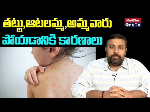 Measles and Chicken Pox What is The Diffrence l Dr.Sandeep Reddy