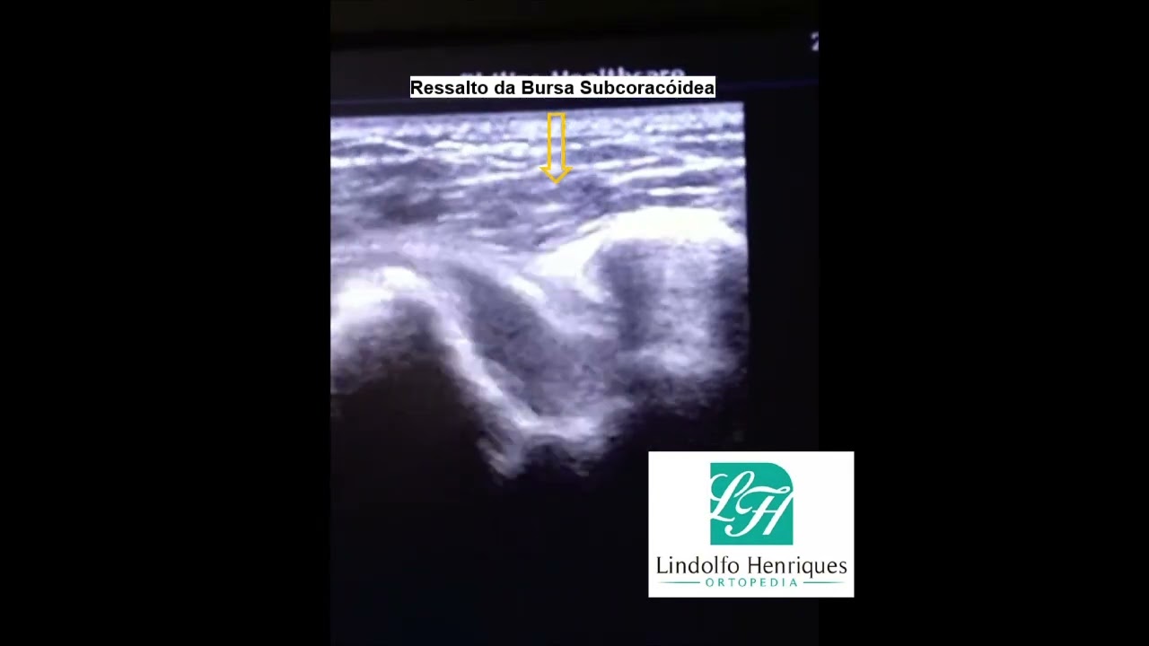 Lindolfo Henriques-10