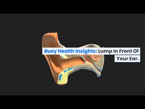 Lump in Front of Your Ear: Common Causes and When to Seek Medical Care  | BuoyHealth.com