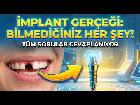 Türkiye'de All-on-6 diş implantı tedavisi Video