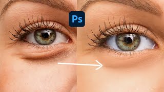 Remove Eye Bags in Photoshop Easy and Fast