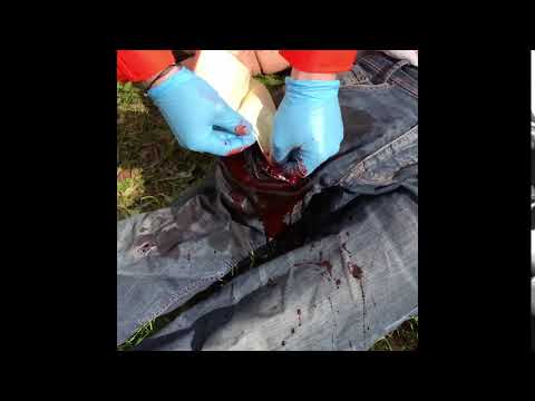 Εκπαιδευτικό Ομοίωμα Τραύματος από Σφαίρα με Λειτουργία Αιμορραγίας Εκπαιδευτικό Ομοίωμα Τραύματος από Σφαίρα με Λειτουργία Αιμορραγίας