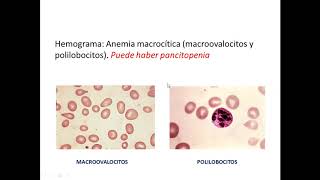 Anemia - 2da Parte - Dr. Juan Zunino