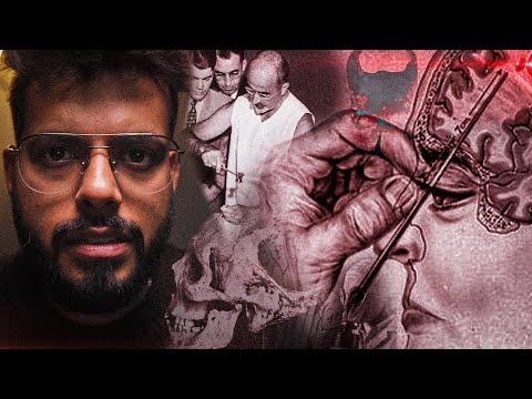HORRIFYING BANNED MEDICAL PROCEDURES || MEDICAL HORRORS || FING