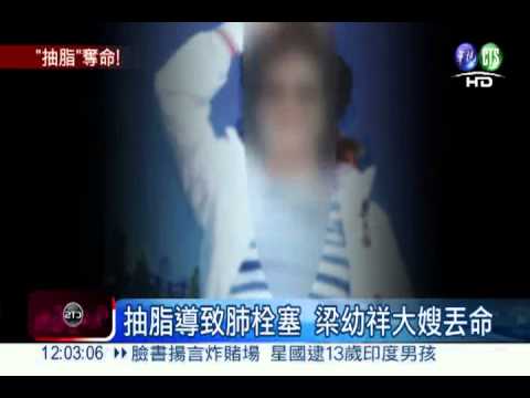 抽脂致肺栓塞 梁幼祥大嫂送命