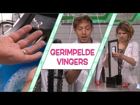 RIMPELIGE VINGERS, WAAROM KRIJG JE ZE EIGENLIJK?! - TOPDOKS LABEXPERIMENT