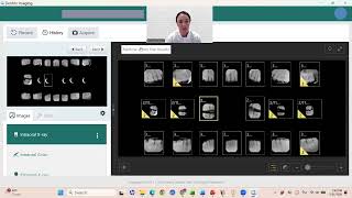 Dentrix Imaging Software Viewing Rads Tutorial