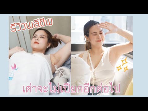 โบท็อก ที่ไหนดี