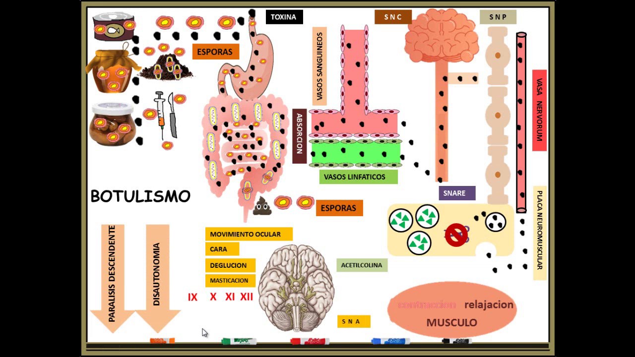 clostridium botulinum BOTULISMO