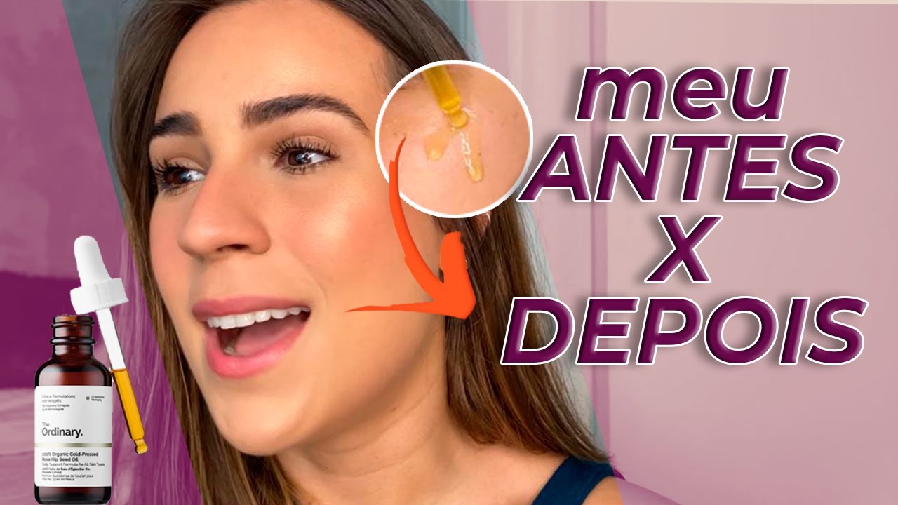 ÓLEO DE ROSA MOSQUETA: tudo sobre ele e a minha experiência!