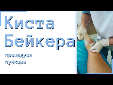 Боль в ноге в суставе большого пальца ноги Расстройство кишечника боль в пояснице