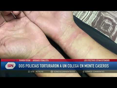 Dos policías de la unidad de Monte Caseros están detenidos y en disponibilidad por torturas