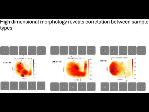 Webinar: Defining the Triple Negative Breast Cancer Morpholome