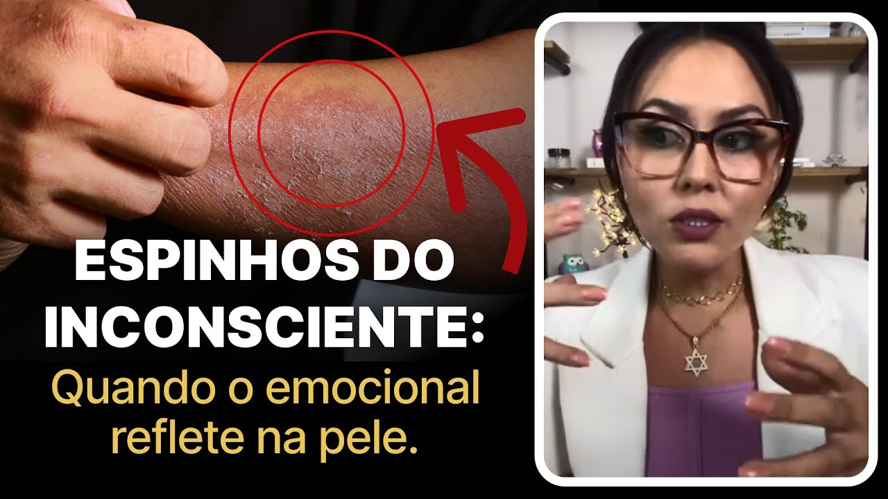 Qual a relação das alergias de pele e o emocional?