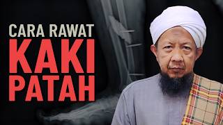 Cara Sebenar Untuk Rawat Kaki Patah - Ustaz Ahmad Rozaini