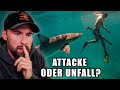 16 Year Old Shark Attack