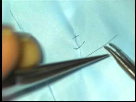 Prostatitis und frische Säfte Prostate Ton Schwächung