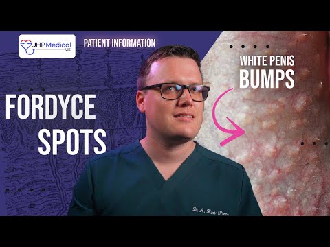 Fordyce Spots (Granules) | Yellow or White Lumps on the Penis | Doctor's Review