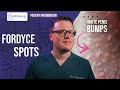 Fordyce Spots Granules Yellow Or White Lumps On The Penis Doctor S Review