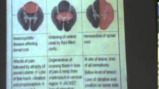 7) Dr. Maha Sabry 4/12/2014  [Lesions of the sensory system]