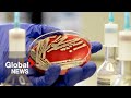E Coli Outbreak How To Protect Yourself From Bacteria Infection