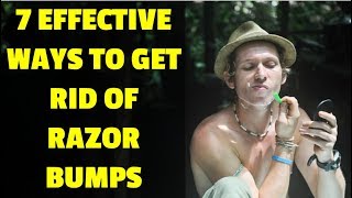 7 Effective Ways to Get Rid of Razor Bumps - How to Get Rid of Razor Burn