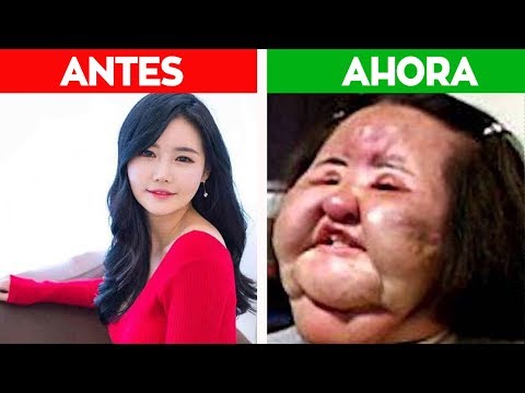 20 Famosas que las CIRUGIAS las dejaron TERRIBLES