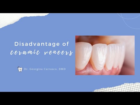 The disadvantage having Ceramic Veneers